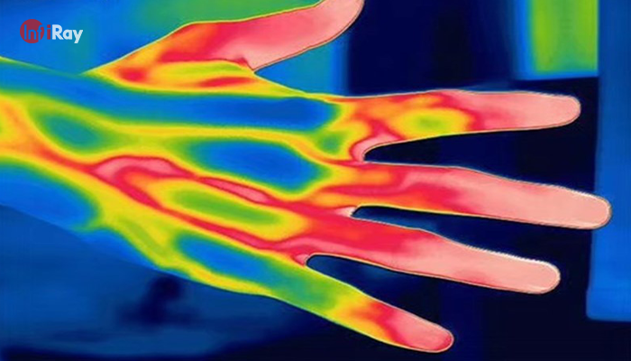 01InfiRay_thermal_imaging_camera_detects_human_blood_vessels.png
