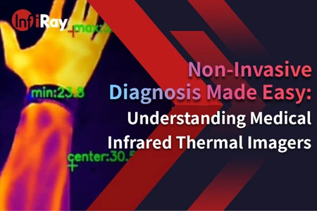 Non-Invasive Diagnosis Made Easy: Understanding Medical Infrared Thermal Imagers
