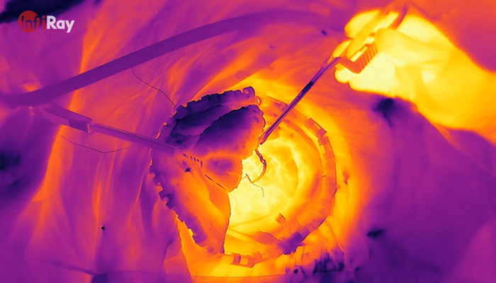  thermal imaging camera used in brain medical