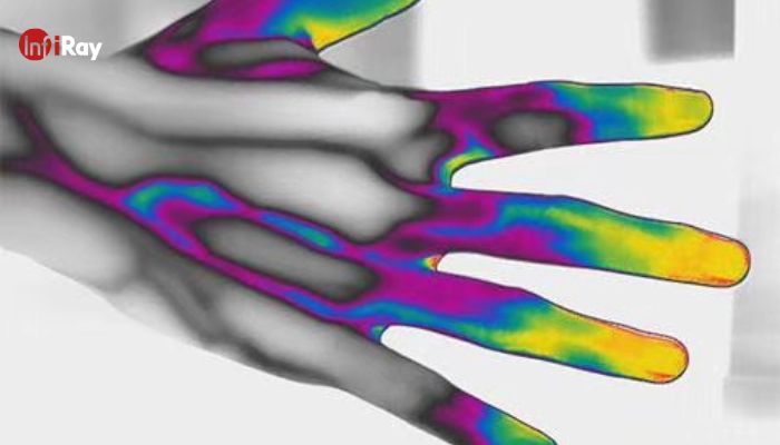 12_Vessels_on_the_dorsum_of_the_hand_in_thermal_vision.jpg